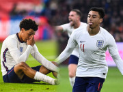 Bóng đá - ĐT Anh nhận 2 tin &quot;sét đánh&quot;, Lingard sáng cửa thay Arnold đá EURO 2021