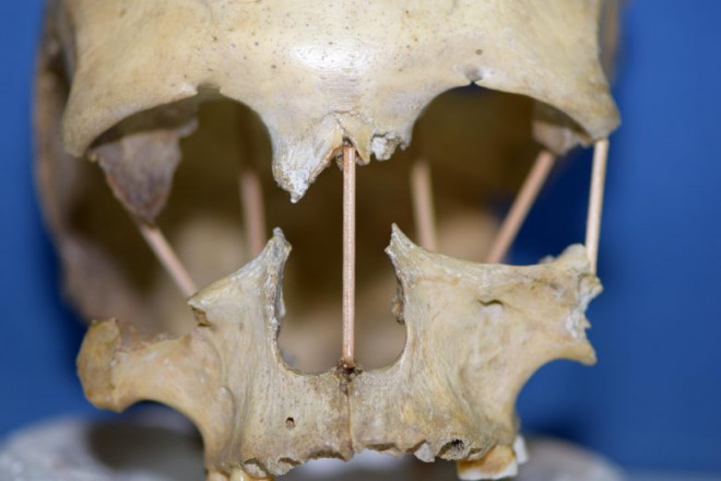 Hộp sọ của cô gái Homo sapiens còn mang nhiều yếu tố Neanderthals 35.000 năm trước - Ảnh: Đại học Uppsala