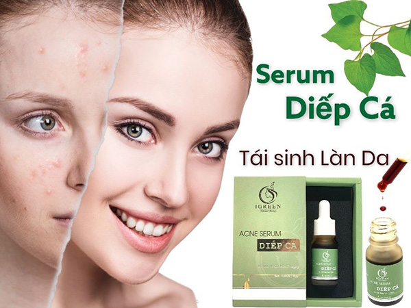 Serum giúp Doanh nhân Trang Moon bén duyên cùng IGREEN