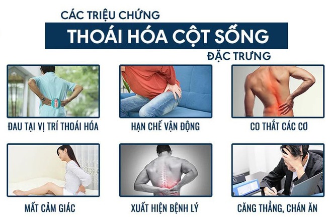 Tại sao người trẻ bị đau vai gáy, đau lưng liên tục? Chuyên gia tiết lộ thủ phạm không ngờ trên VTV3! - 1