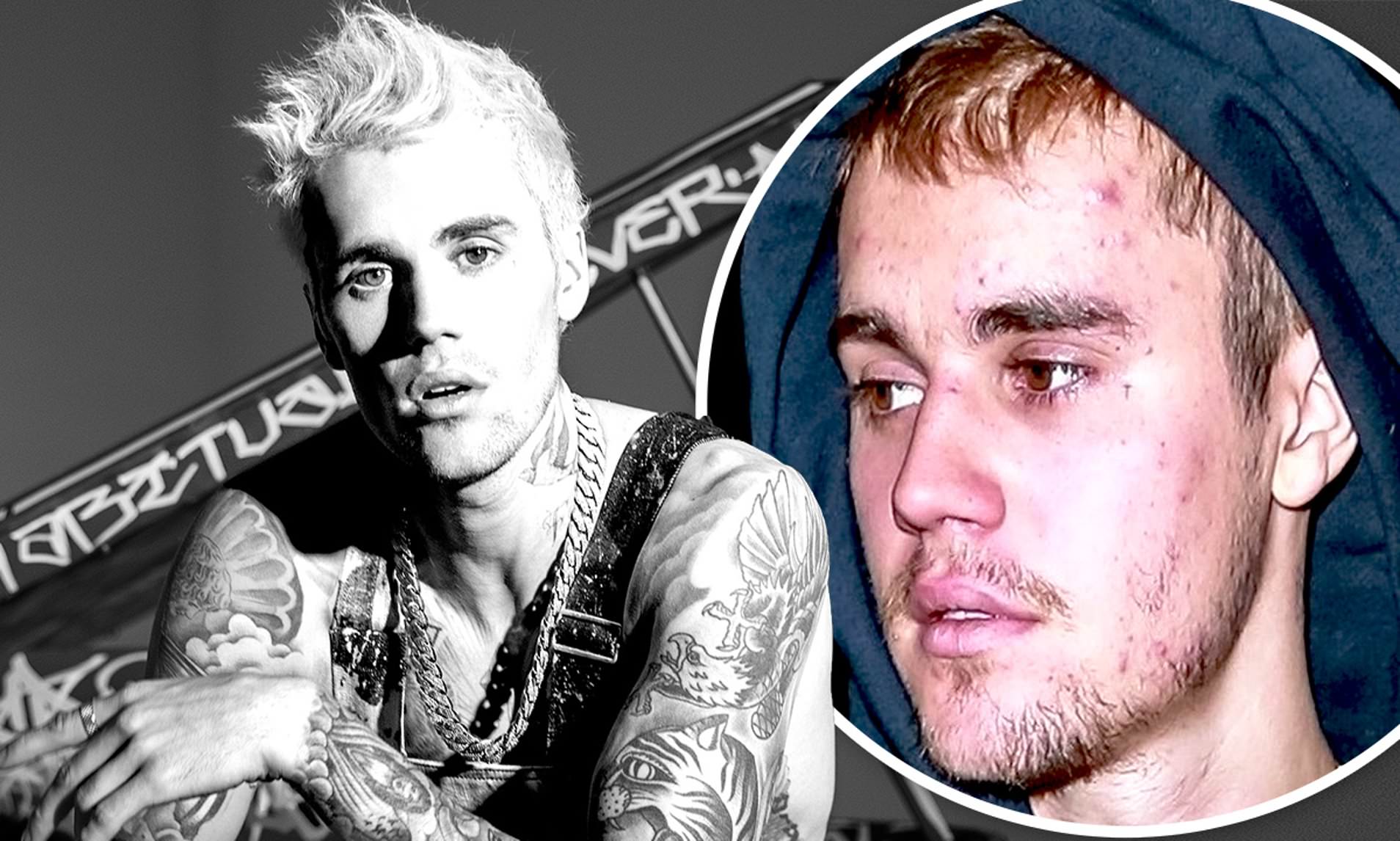 "The Prince of Pop"  Justin Bieber has a strange disease, difficult to diagnose, but with very serious consequences - 1