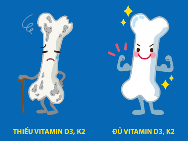 Không chỉ trẻ em, đây là 3 nhóm đối tượng cần bổ sung ngay vitamin K2 để &#34;xương chắc, dáng cao&#34; - 4