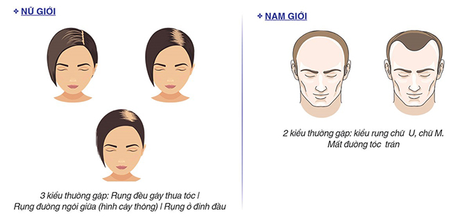 Hair loss a lot, thinning scalp, how to grow hair fast again?  - 3