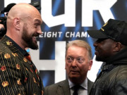 Thể thao - &quot;Vua giang hồ&quot; Tyson Fury đấu Dillian Whyte: Lần cuối so tài nảy lửa