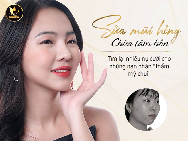 Sửa mũi hỏng – chữa tâm hồn: Cơ hội cho những nạn nhân thẩm mỹ chui (Ảnh: Saigon Star)