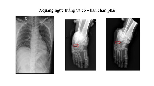 Tai nạn lao động luôn tiềm ẩn nguy hiểm khôn lường, cộng đồng cần nâng cao cảnh giác