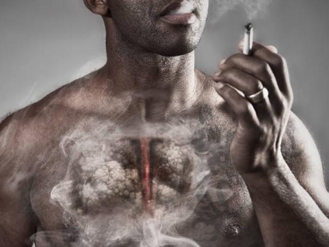 Ngoài ung thư vòm họng, bạn còn có nguy cơ mắc thêm 9 loại ung thư nếu tiếp tục hút thuốc lá