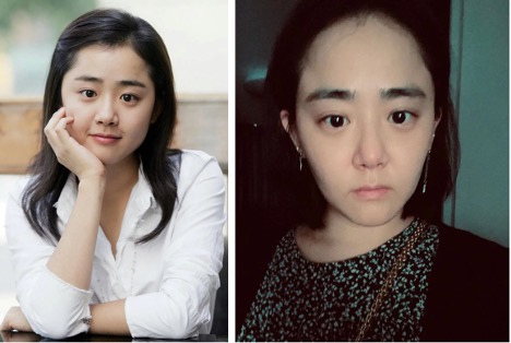 "Em gái quốc dân" xứ Hàn từng mắc bệnh nguy hiểm, không thể tiếp tục đóng phim - 1