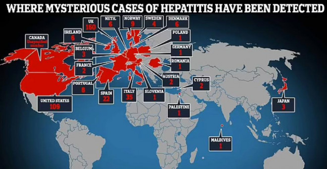 Đã có khoảng 450 trường hợp trẻ em mắc bệnh gan bí ẩn tại 21 quốc gia kể từ tháng 4. Ảnh: Daily Mail.