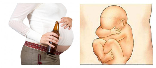 Người mẹ uống rượu trong khi mang thai sẽ ảnh hưởng đến sự phát triển của thai nhi.