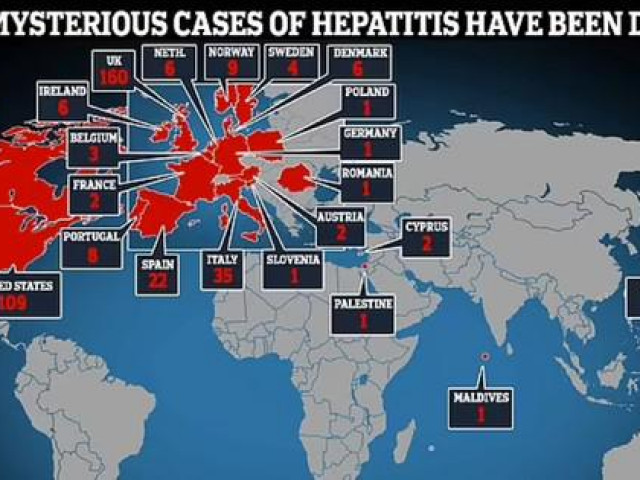 Bệnh viêm gan bí ẩn tiếp tục diễn biến phức tạp trên toàn thế giới