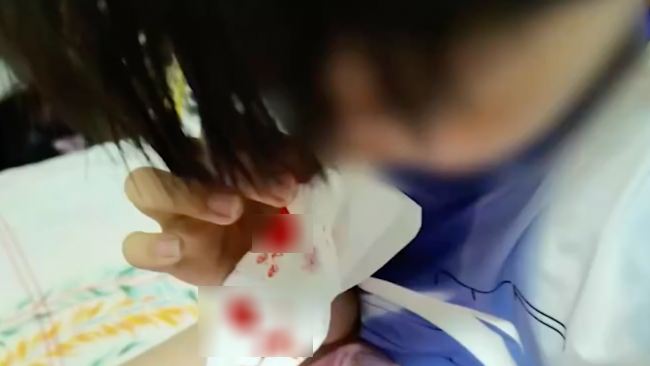 Hơn 100 trẻ em bị chảy máu mũi bất thường ở thành phố Thương Khâu, tỉnh Hà Nam, miền trung Trung Quốc những ngày gần đây khiến người dân lo lắng. Ảnh: Weibo
