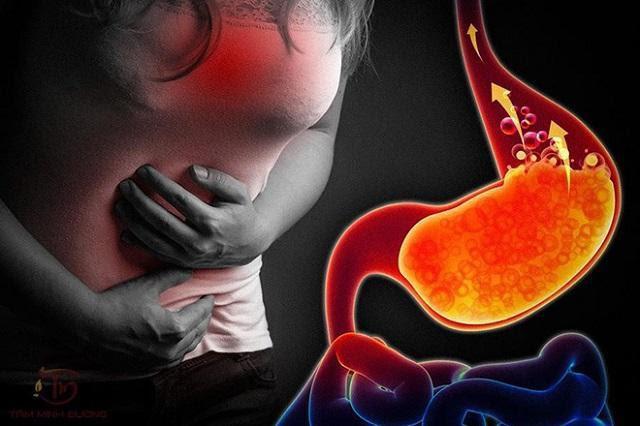 6 signs of gastroesophageal reflux disease are easy to confuse with other diseases, experts recommend stopping this - 1