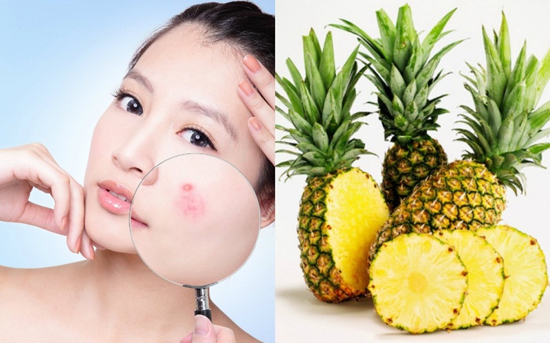 Keep your skin crystal clear and slim with pineapple juice - 1