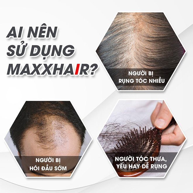 Get rid of hair loss, baldness clinging for 5 years thanks to this way - 6