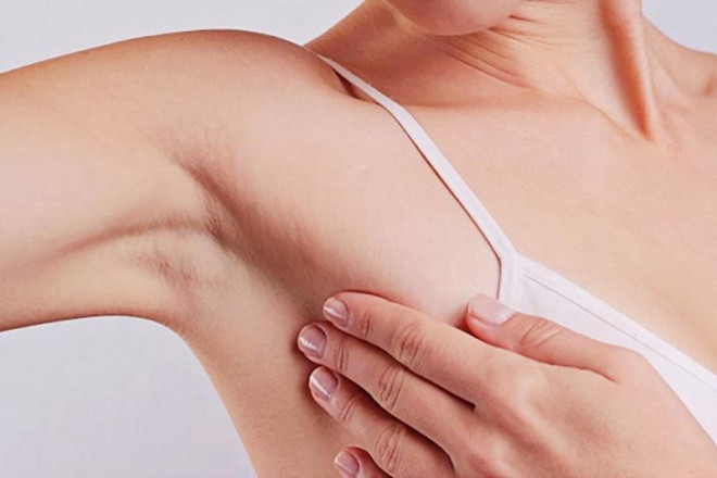 Detecting breast cancer from just a pimple on her chest, the 24-year-old girl was shocked - 3