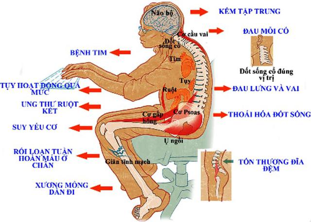 Thói quen đáng sợ rút ngắn tuổi thọ của dân văn phòng, chuyên gia khuyến cáo chỉ cần kết hợp động tác này sẽ hạn chế rủi ro - 3