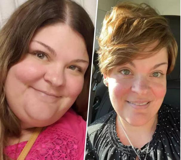 Người phụ nữ 39 tuổi phát hiện sớm ung thư nhờ giảm cân, chuyên gia chỉ rõ 5 lý do chính nên giảm cân càng sớm càng tốt - 1