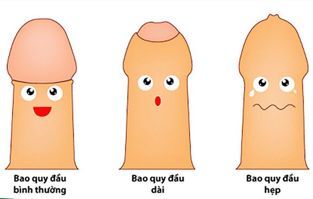 Hẹp bao quy đầu ở nam giới: Nguyên nhân, triệu chứng và cách điều trị - 1