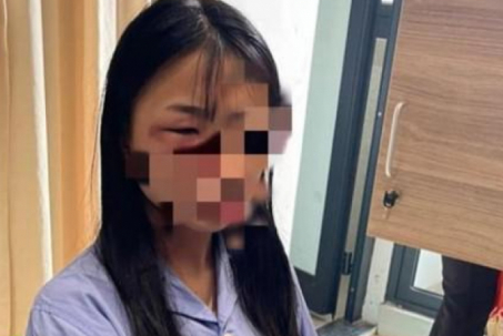 Làm rõ vụ một nữ sinh lớp 8 bị đánh hội đồng ở Hà Nội