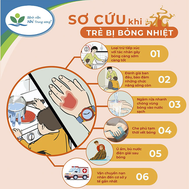 6 bước sơ cứu cho trẻ khi bị bỏng mọi người cần biết - 1