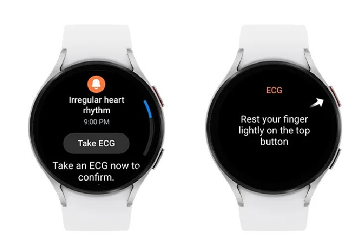 Samsung Galaxy Watch sắp có tính năng đáng giá cho người có vấn đề về tim mạch - 1