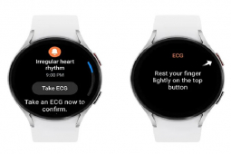 Samsung Galaxy Watch sắp có tính năng đáng giá cho người có vấn đề về tim mạch