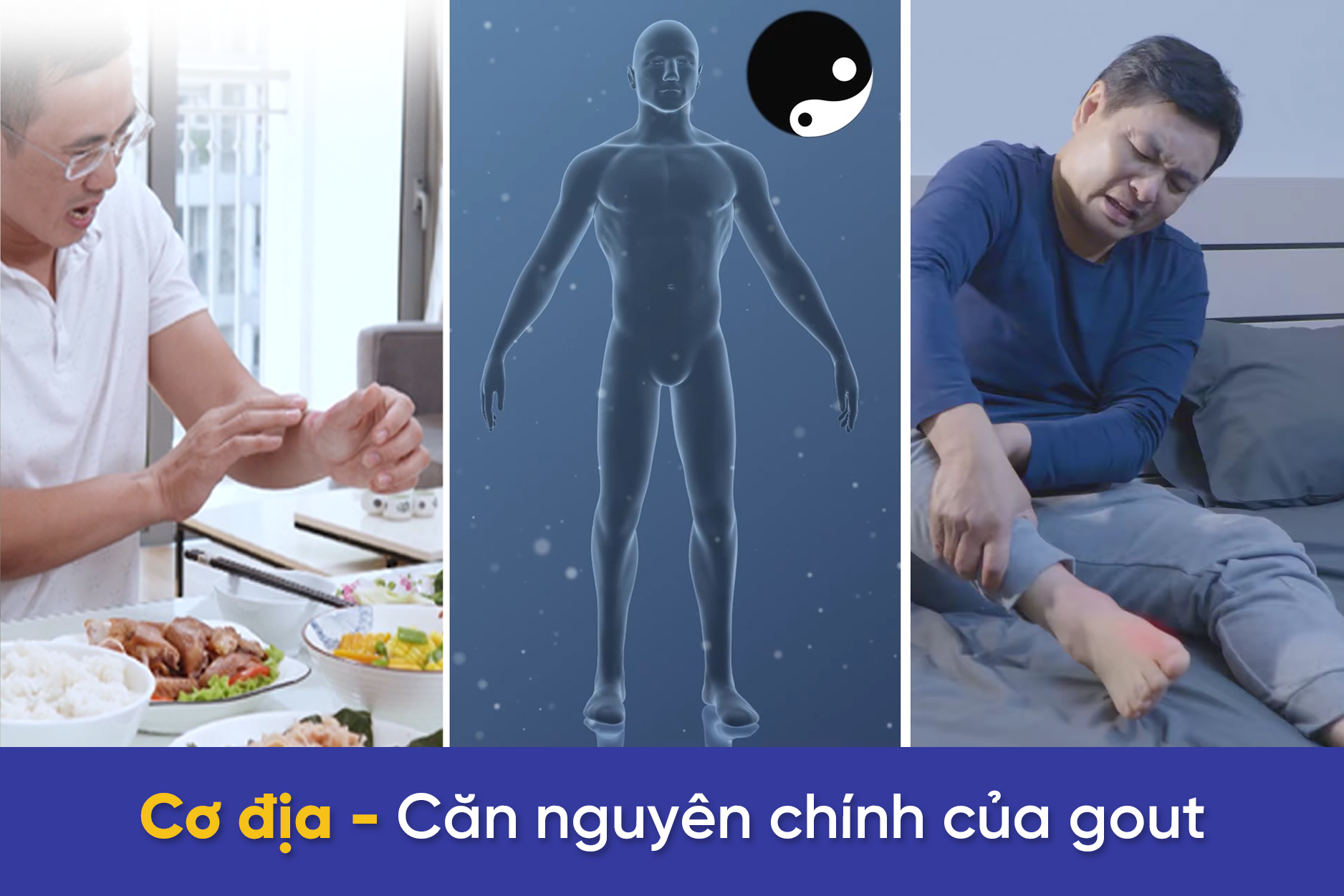 Bị gút lâu, người đàn ông càng bất lực khi bị thêm biến chứng sỏi thận - 2