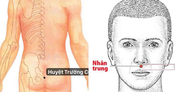 Cần xử trí đúng, khẩn cấp khi nam giới bị thượng mã phong