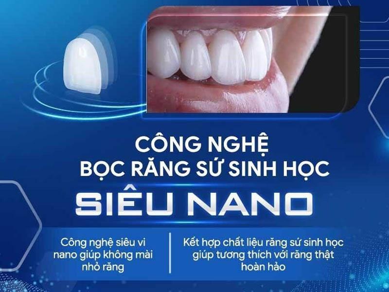 ViDental Clinic ứng dụng công nghệ bọc răng sứ sinh học NANO BIOTECH an toàn, hiệu quả