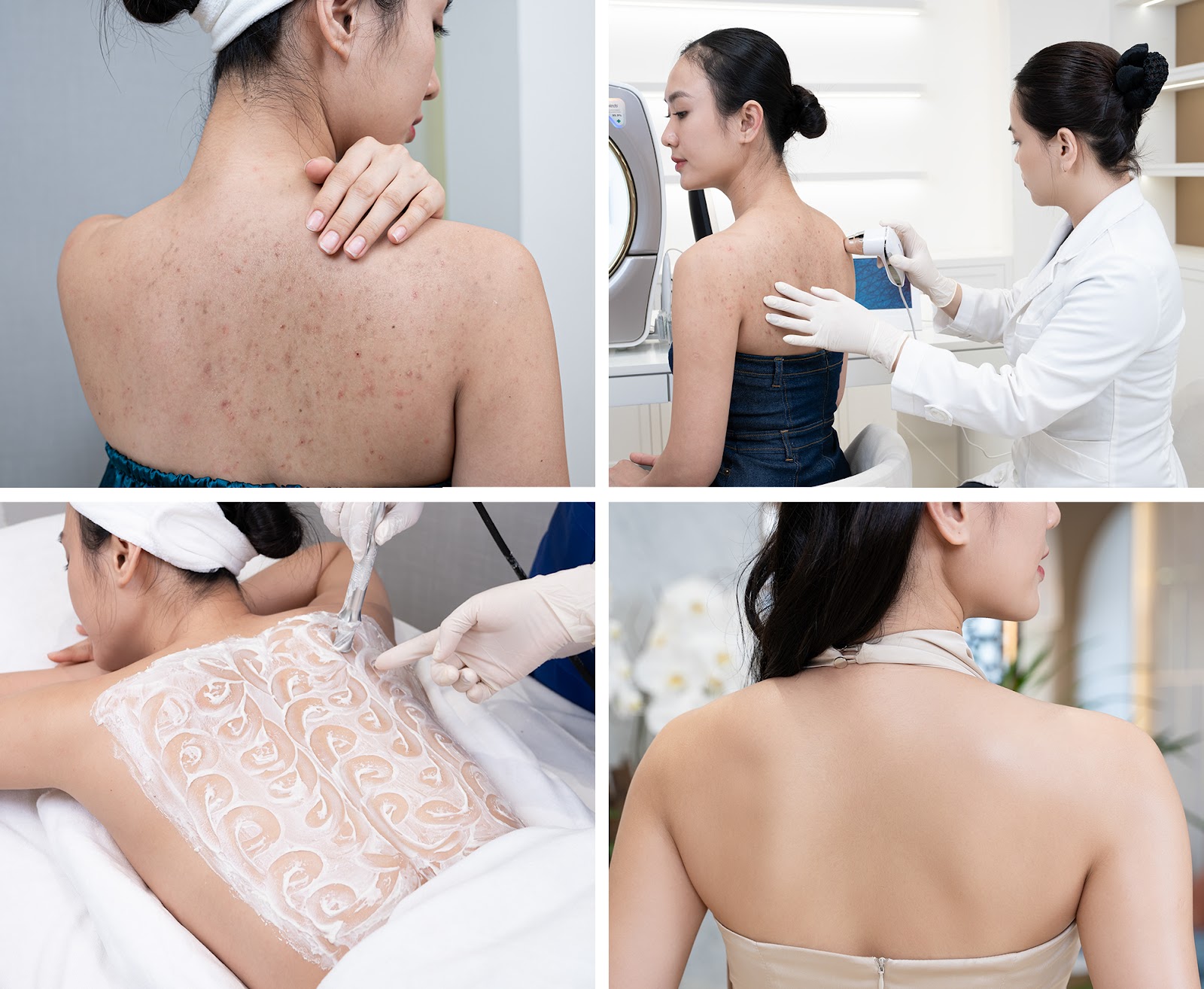 Hàng triệu chị em phụ nữ Việt đã tin tưởng và lựa chọn công nghệ trị viêm da, viêm nang lông Smooth Ultra và gặt hái được kết quả thay đổi ngoạn mục 