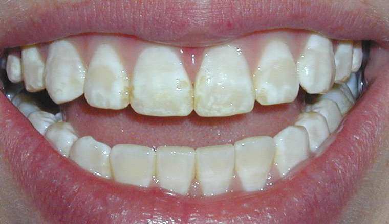 6 bệnh về răng miệng nguy hiểm cần phát hiện sớm- Ảnh 1.