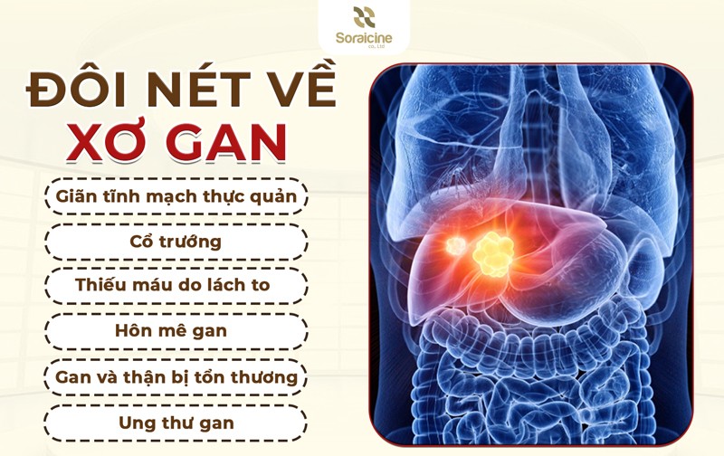 TPBVSK Nitasora: Liệu pháp hỗ trợ bảo vệ gan an toàn, hiệu quả - 2