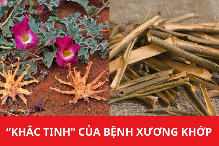 Giật mình 3 dấu hiệu cảnh báo viêm khớp dạng thấp nhiều người bỏ qua - 3