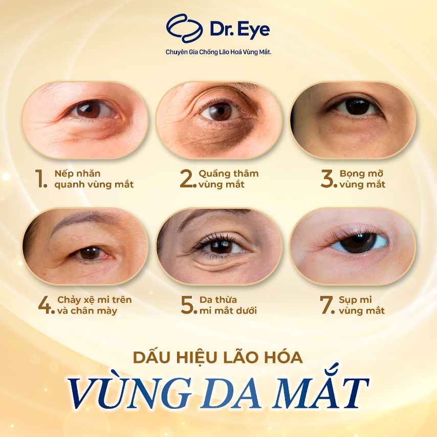 Dr. Eye – Trung tâm chuyên sâu chống lão hóa vùng mắt - 1