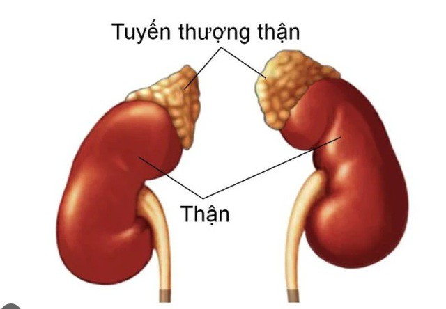 Suy tuyến thượng thận thường gặp ở bệnh nhân dùng corticoid kéo dài.