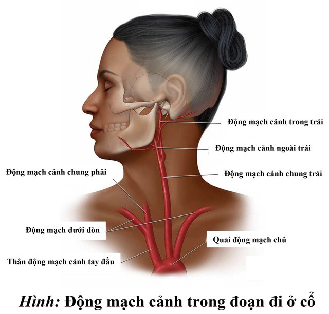 Hình minh hoạ động mạch cảnh trong đoạn đi ở cổ