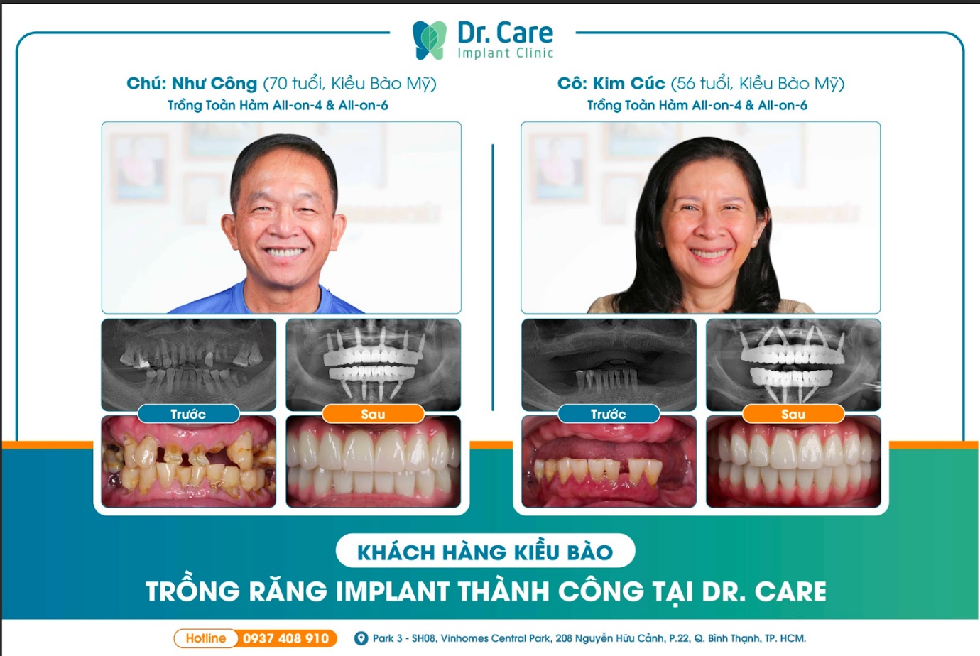 Dr. Care - Implant Clinic: Nha khoa trồng răng Implant tại TP.HCM kiều bào tin tưởng lựa chọn - 5