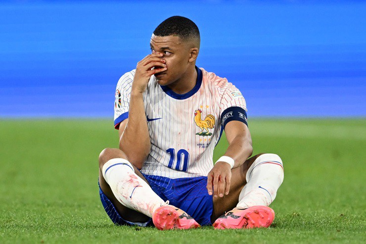 Mbappe&nbsp;bị gãy mũi trong trận thắng của ĐT&nbsp;Pháp trước ĐT&nbsp;Áo