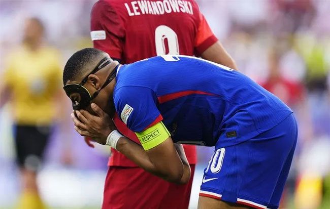 Mbappe ôm mũi sau pha va chạm với Lewandowski. Ảnh: SIPA