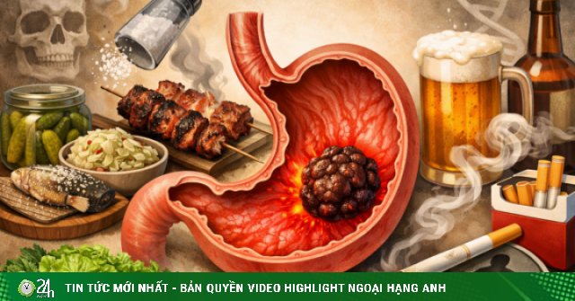 4 thói quen ăn uống âm thầm 'nuôi' ung thư dạ dày