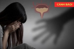  Đây mới là “sát thủ giấu mặt” khiến bạn tiểu nhiều, không phải do “thận yếu”!