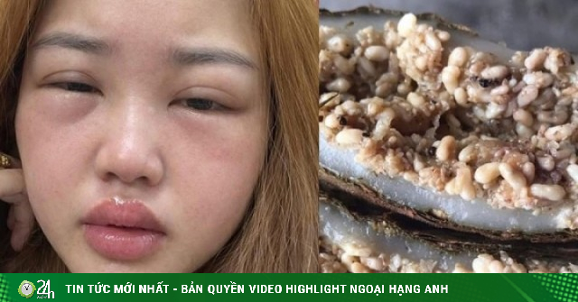 Thưởng thức bánh trứng kiến đang hot: Người khen ngon, người nhập viện vì sốc phản vệ