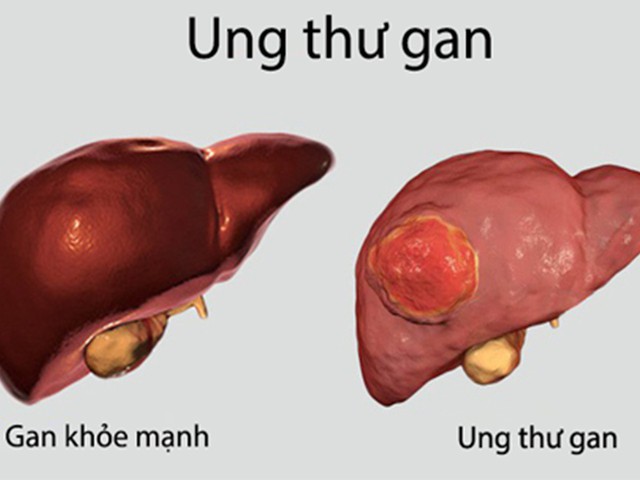 Ảnh minh họa.