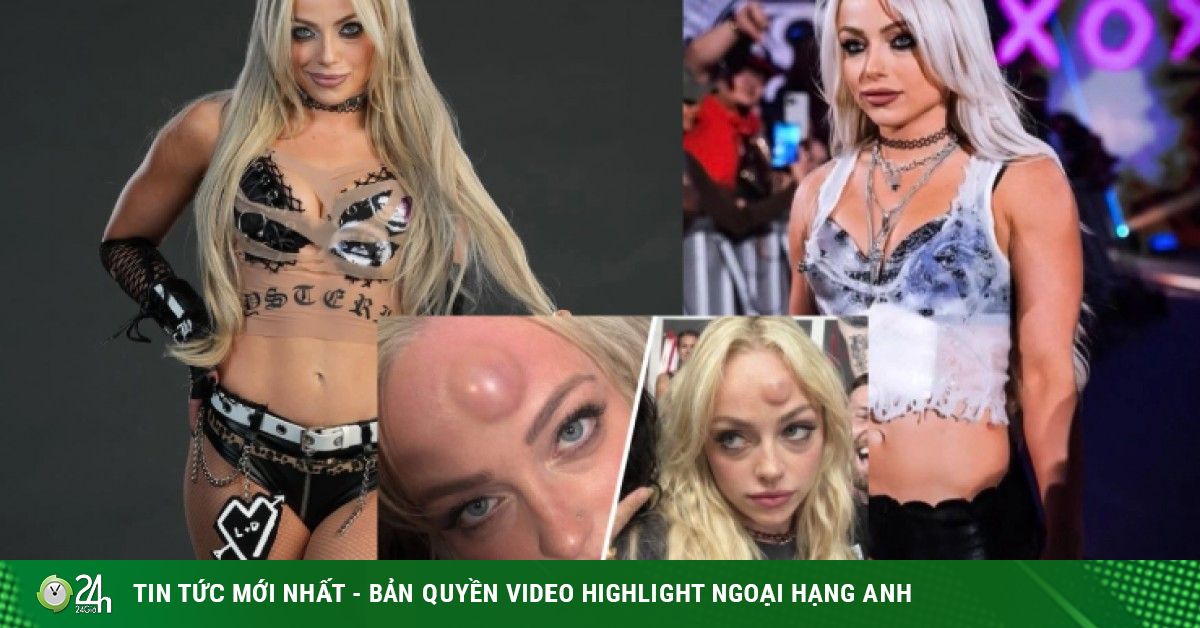 Mỹ nhân vật hết trận vẫn bị tấn công đáng sợ: Vỡ đầu, chấn động não