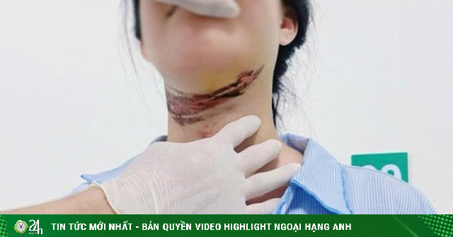 Nữ sinh bị dây điện quấn vào cổ trên đường đi học về