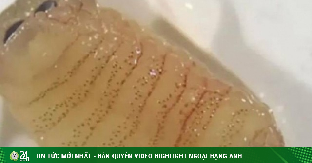 Người phụ nữ hắt hơi ra nhiều con giòi sống