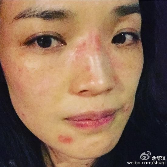 Weibo