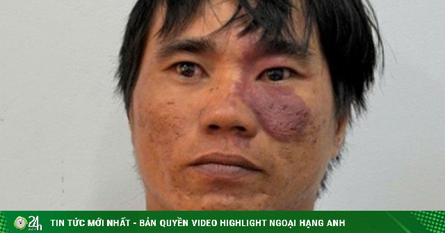 Đòi nợ không thành, người đàn ông bị con nợ đánh tử vong