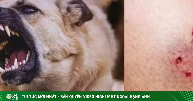 Chó 'điên' cắn 4 người ở Quảng Ngãi dương tính vi rút dại